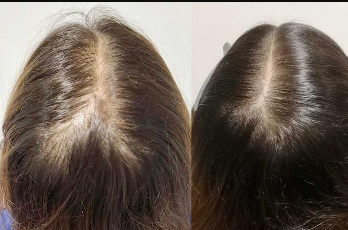 Postpartum Hair Growth Serum | Rosemary, Biotin, Ginseng & Ginger Root for New Mums